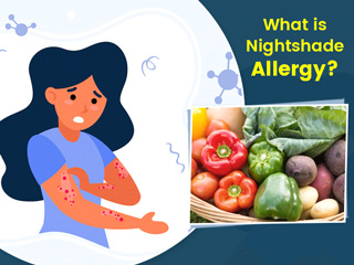 Nightshade Allergy: Read To Know How Vegetables An...